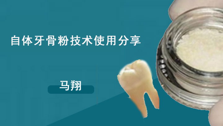 自体牙骨粉技术使用分享-马翔